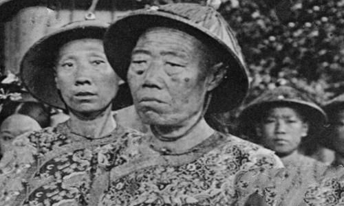 李莲英的舌头特别长是真吗?