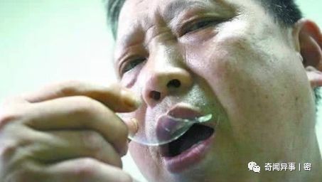 全球五花八门的异食癖，真不敢相信！