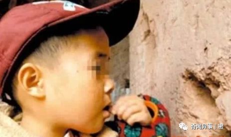 全球五花八门的异食癖，真不敢相信！