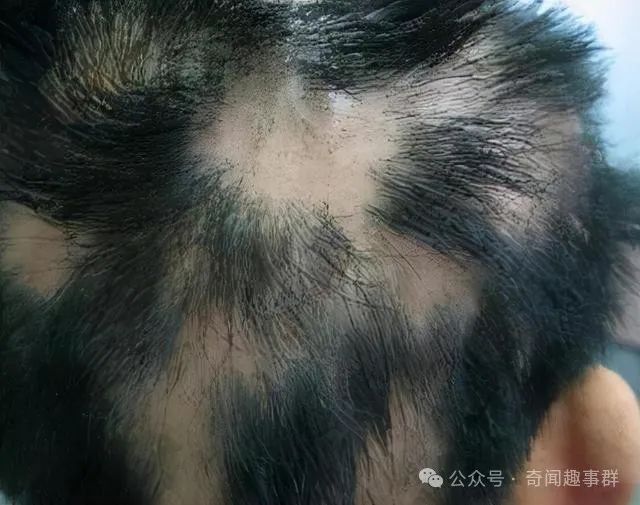 贵州村庄遇鬼剃头一夜脱发，中科院专家去调查，一夜变光头