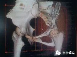 无比异常的“红王后”骨骼，究竟是什么？难道真是外星人头骨？
