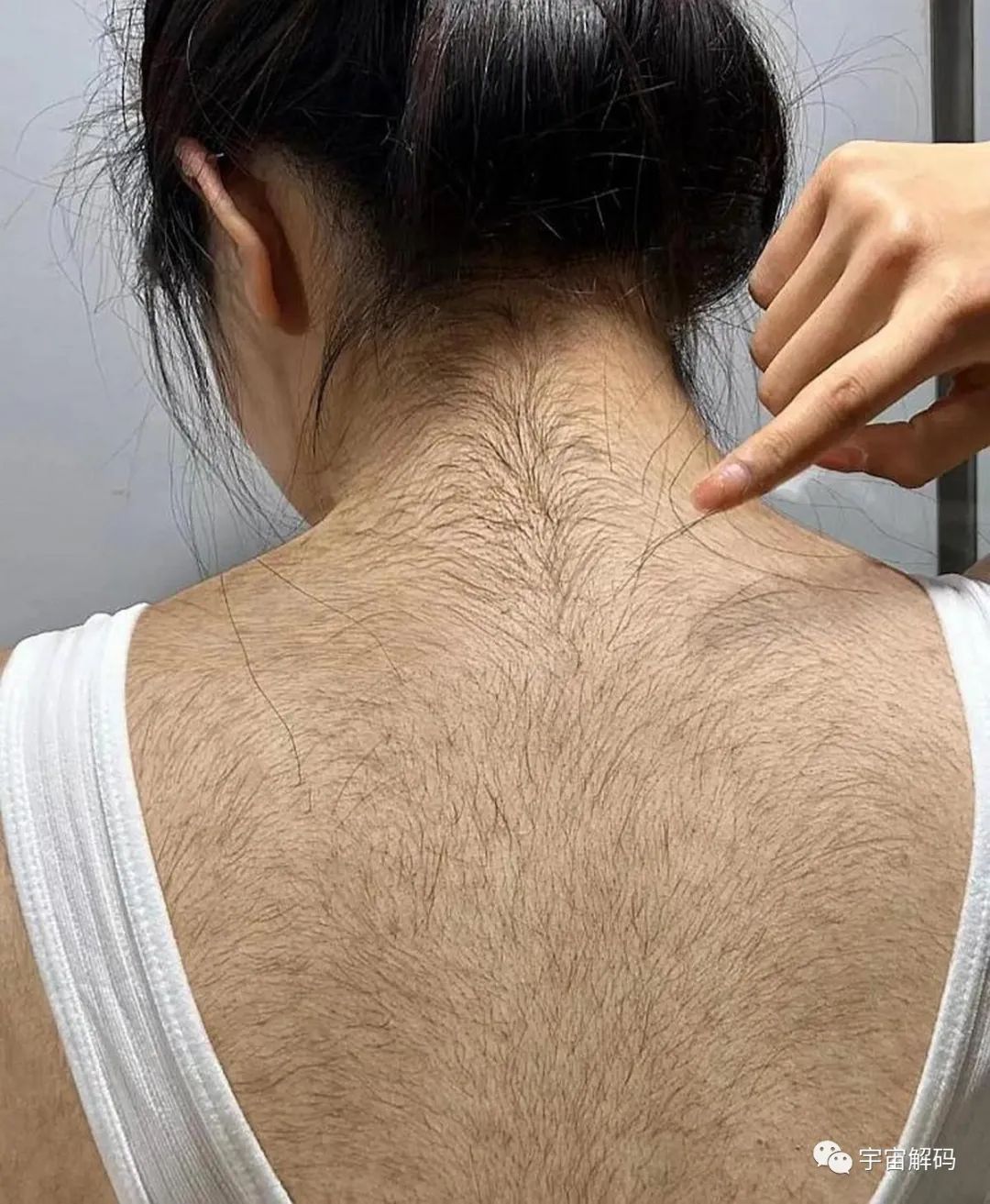 为何白种人的体毛要比我们黄种人体毛旺盛？