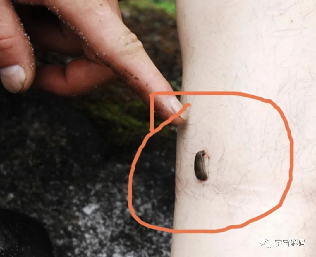 水蛭如果不小心吃肚子里了，在人的肚子里还可以活吗？