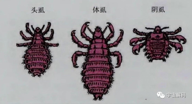 虱子与人类的“缠绵史”：与我们共存千万年，现在却很少见到了？