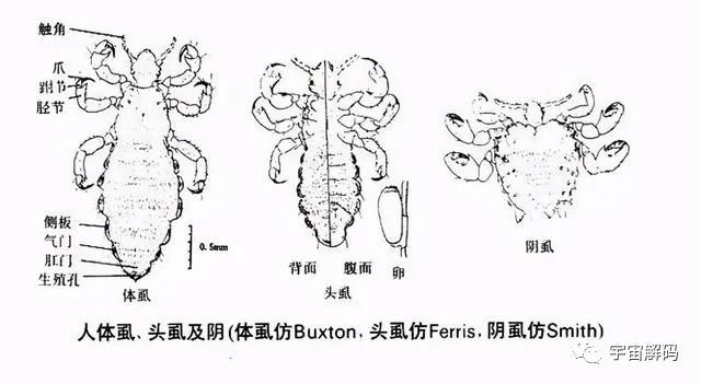 虱子与人类的“缠绵史”：与我们共存千万年，现在却很少见到了？