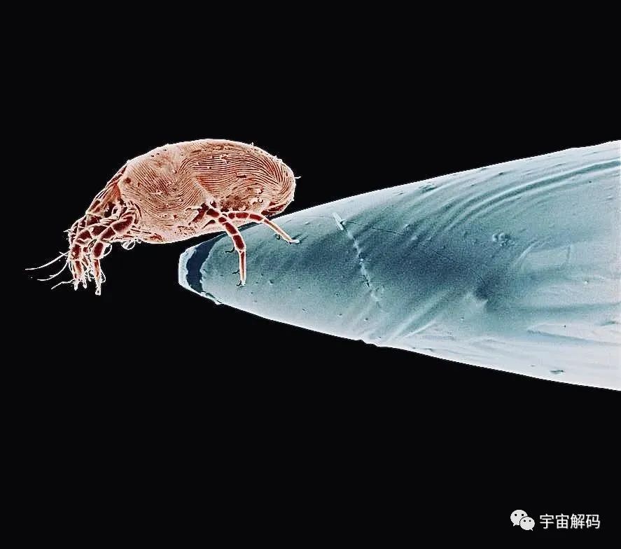 小小的微生物放大了竟然如此可怕——显微镜下的微型生物