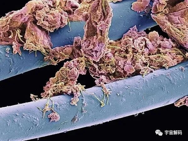 小小的微生物放大了竟然如此可怕——显微镜下的微型生物
