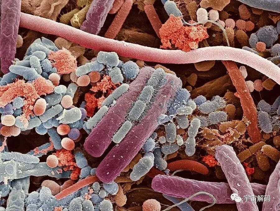 小小的微生物放大了竟然如此可怕——显微镜下的微型生物