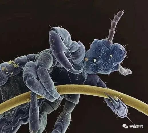 小小的微生物放大了竟然如此可怕——显微镜下的微型生物