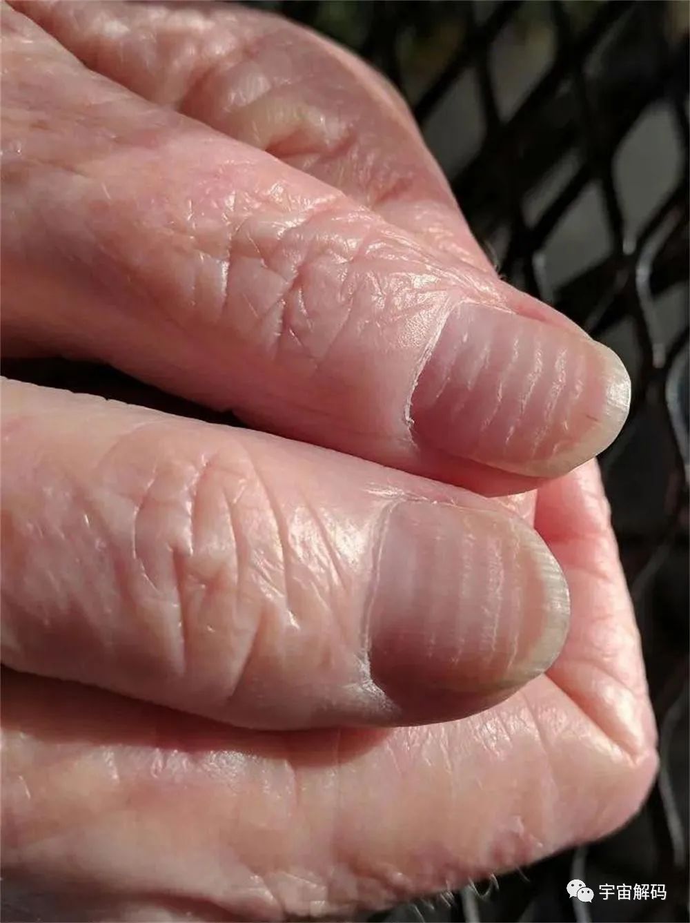 看完这组震撼的照片，才知道时间有多残酷…