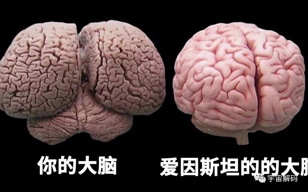 爱因斯坦的大脑被切成了240片，一部分居然被弄丢了！