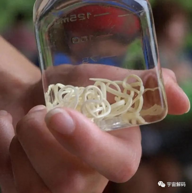 非洲“龙线虫”究竟有多恐怖？为何说它是人类为数不多的天敌之一