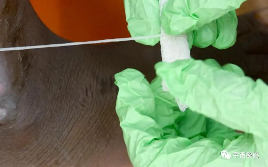 非洲“龙线虫”究竟有多恐怖？为何说它是人类为数不多的天敌之一