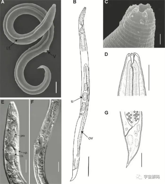 科学家成功复活永久冻土层中冰封4.6万年的蛔虫！潘多拉魔盒已打开