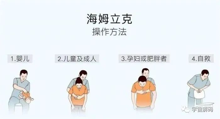 救过无数人生命的海姆立克急救法，作用是什么