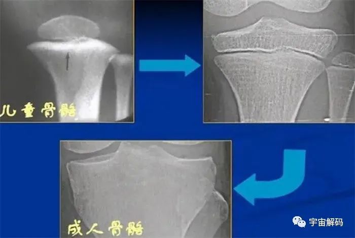 黑种人、黄种人、白种人有在身体结构上什么不同？