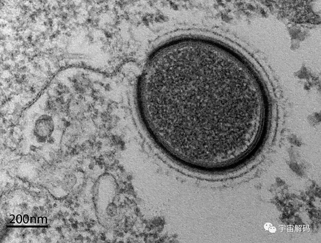 北极发现5.7万年前尸体，科学家提醒可能有更危险的东西